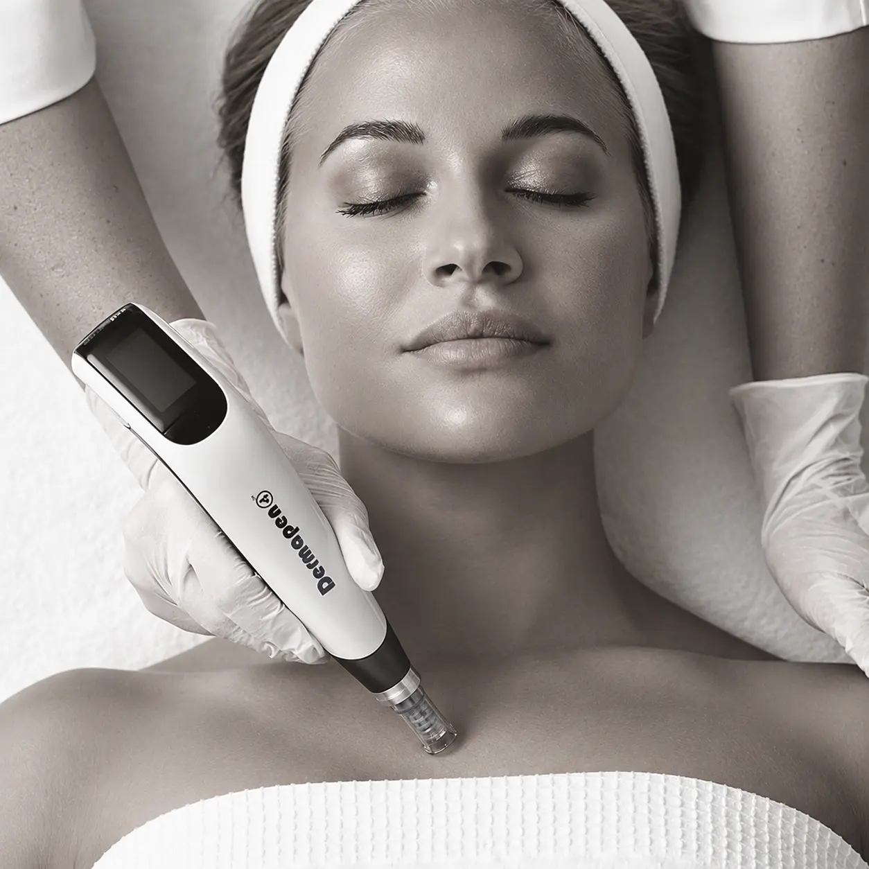 Dermapen4-Microneedling-Behandlung am Dekolleté